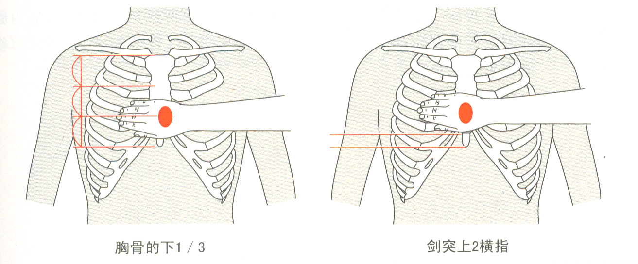廣州壹傳誠VR 心肺復(fù)蘇模擬 心肺復(fù)蘇虛擬仿真系統(tǒng) 虛擬心肺復(fù)蘇